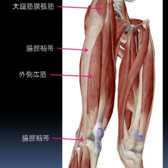 ランナーの下肢外側の痛みに対するインソール
